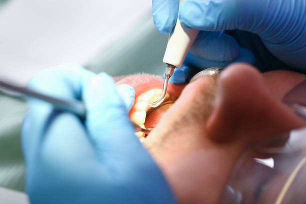 Best Weekend Emergency Dentist in Bayshe, OR