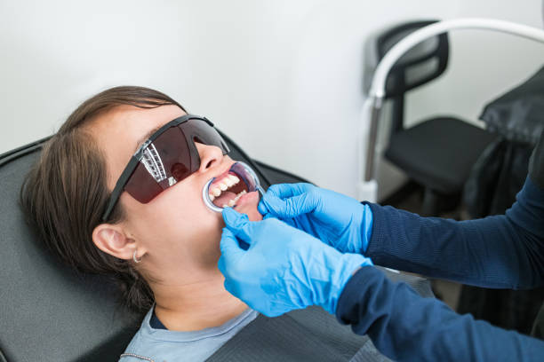 Best Emergency Tooth Extraction in Bayshe, OR